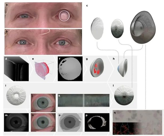 Revolutionizing Prosthetic Eyes with 3D Printing Technology